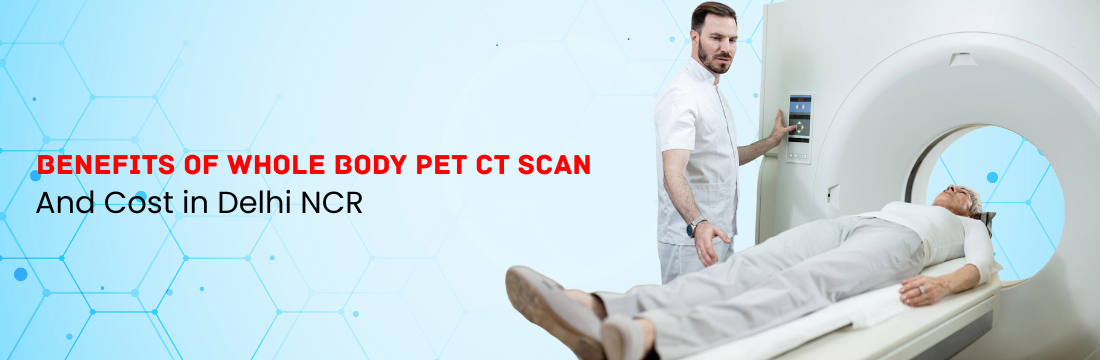 Benefits of Whole Body PET CT Scan and Cost in Delhi NCR